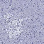 KLHL33 Antibody in Immunohistochemistry (Paraffin) (IHC (P))