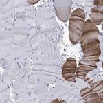 KLHL33 Antibody in Immunohistochemistry (Paraffin) (IHC (P))