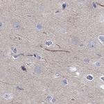 ABCG4 Antibody in Immunohistochemistry (Paraffin) (IHC (P))