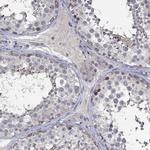 DDX3Y Antibody in Immunohistochemistry (Paraffin) (IHC (P))