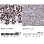 SLC35F2 Polyclonal Antibody