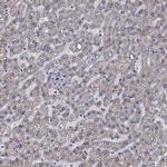 SLC35F2 Antibody in Immunohistochemistry (Paraffin) (IHC (P))
