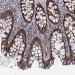 SLC35F2 Antibody in Immunohistochemistry (Paraffin) (IHC (P))