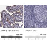 ANKS4B Polyclonal Antibody