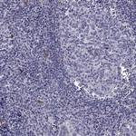 ANKS4B Antibody in Immunohistochemistry (Paraffin) (IHC (P))