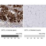 VAT1L Polyclonal Antibody