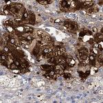 VAT1L Antibody in Immunohistochemistry (Paraffin) (IHC (P))
