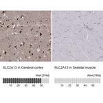 SLC2A13 Polyclonal Antibody