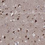 SLC2A13 Antibody in Immunohistochemistry (Paraffin) (IHC (P))