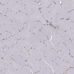 SLC2A13 Antibody in Immunohistochemistry (Paraffin) (IHC (P))