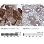 NDUFC1 Polyclonal Antibody