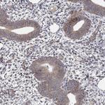 NDUFC1 Antibody in Immunohistochemistry (Paraffin) (IHC (P))