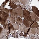 NDUFC1 Antibody in Immunohistochemistry (Paraffin) (IHC (P))