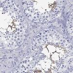 C4orf47 Antibody in Immunohistochemistry (Paraffin) (IHC (P))