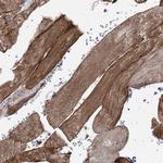 SYNC Antibody in Immunohistochemistry (Paraffin) (IHC (P))