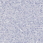 Calcitonin Antibody in Immunohistochemistry (Paraffin) (IHC (P))
