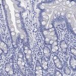 Calcitonin Antibody in Immunohistochemistry (Paraffin) (IHC (P))