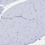 Calcitonin Antibody in Immunohistochemistry (Paraffin) (IHC (P))