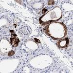 Calcitonin Antibody in Immunohistochemistry (Paraffin) (IHC (P))