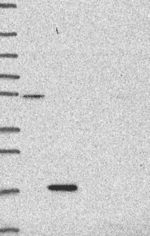Calcitonin Antibody in Western Blot (WB)