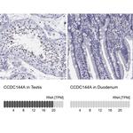 CCDC144A Polyclonal Antibody