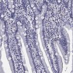 CCDC144A Antibody in Immunohistochemistry (Paraffin) (IHC (P))