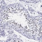 CCDC144A Antibody in Immunohistochemistry (Paraffin) (IHC (P))