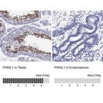 PIWIL1 Polyclonal Antibody
