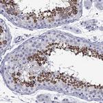 PIWIL1 Antibody in Immunohistochemistry (Paraffin) (IHC (P))