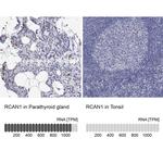 RCAN1 Polyclonal Antibody