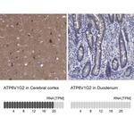 ATP6V1G2 Polyclonal Antibody