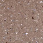 ATP6V1G2 Antibody in Immunohistochemistry (Paraffin) (IHC (P))