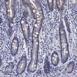 ATP6V1G2 Antibody in Immunohistochemistry (Paraffin) (IHC (P))