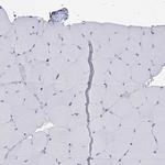 CD162 (PSGL-1) Antibody in Immunohistochemistry (Paraffin) (IHC (P))