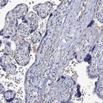 PTPN20A Antibody in Immunohistochemistry (Paraffin) (IHC (P))