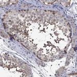 PTPN20A Antibody in Immunohistochemistry (Paraffin) (IHC (P))