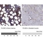 PLCB2 Antibody in Immunohistochemistry (Paraffin) (IHC (P))