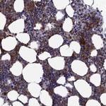 PLCB2 Antibody in Immunohistochemistry (Paraffin) (IHC (P))