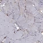 PLCB2 Antibody in Immunohistochemistry (Paraffin) (IHC (P))