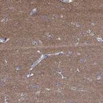 PRRT3 Antibody in Immunohistochemistry (Paraffin) (IHC (P))