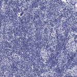 Glypican 1 Antibody in Immunohistochemistry (Paraffin) (IHC (P))