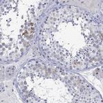 KLHL35 Antibody in Immunohistochemistry (Paraffin) (IHC (P))