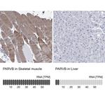 PARVB Polyclonal Antibody