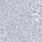 PARVB Antibody in Immunohistochemistry (Paraffin) (IHC (P))