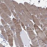 PARVB Antibody in Immunohistochemistry (Paraffin) (IHC (P))