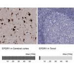 EPDR1 Polyclonal Antibody