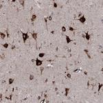EPDR1 Antibody in Immunohistochemistry (Paraffin) (IHC (P))