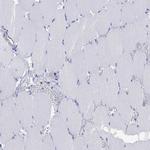 GPR65 Antibody in Immunohistochemistry (Paraffin) (IHC (P))