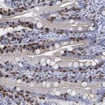 GPR65 Antibody in Immunohistochemistry (Paraffin) (IHC (P))