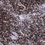 GPR65 Antibody in Immunohistochemistry (Paraffin) (IHC (P))